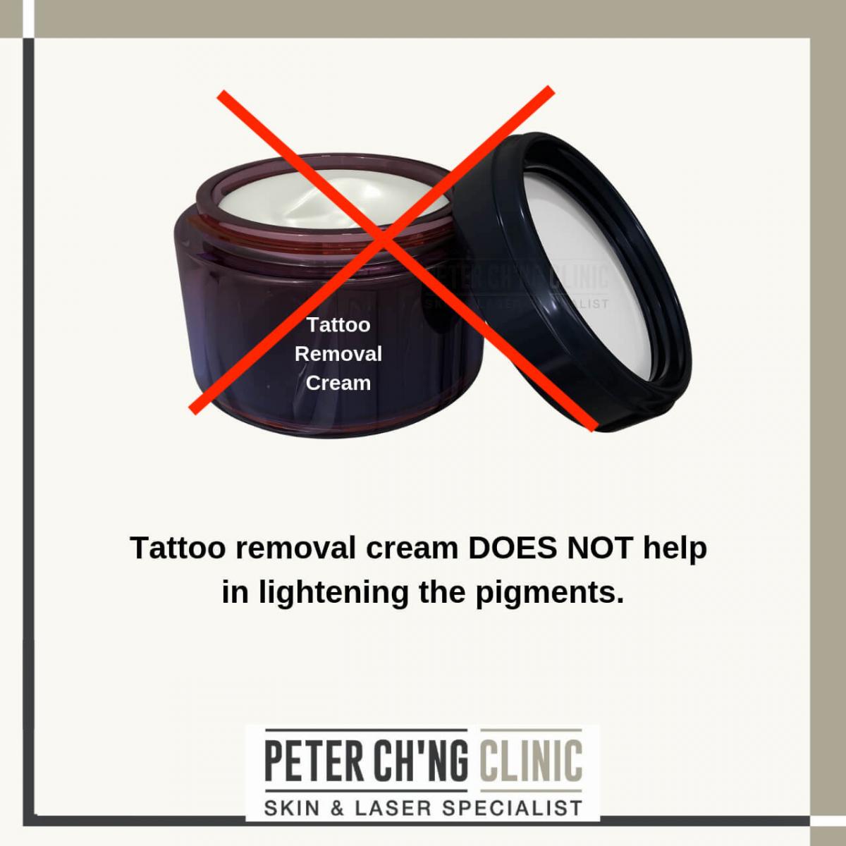 Tattoo removal cream