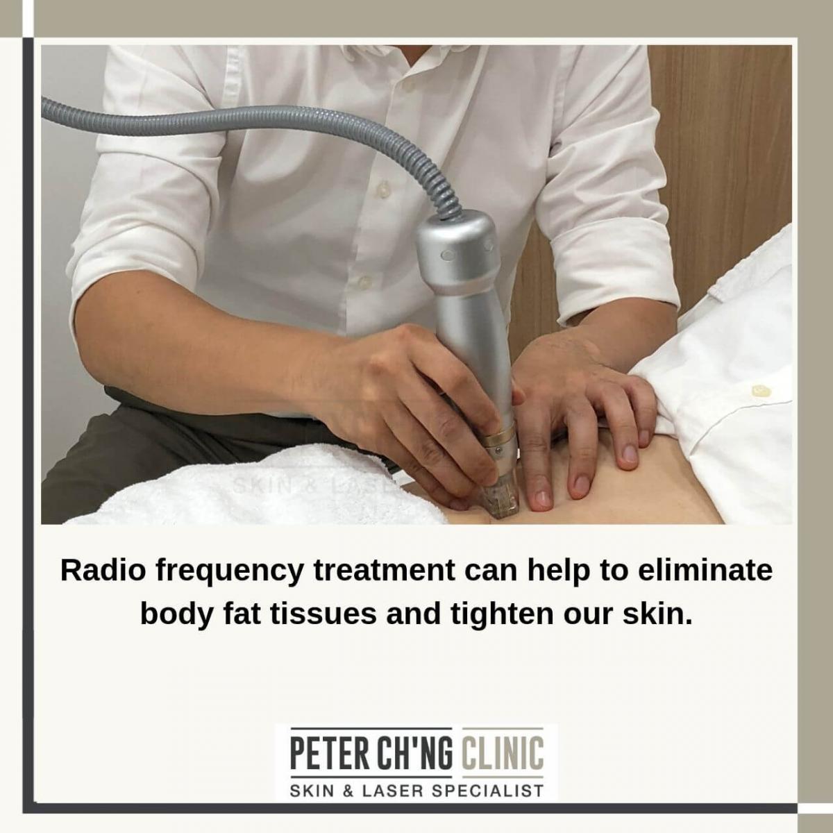 Radio frequency treatment