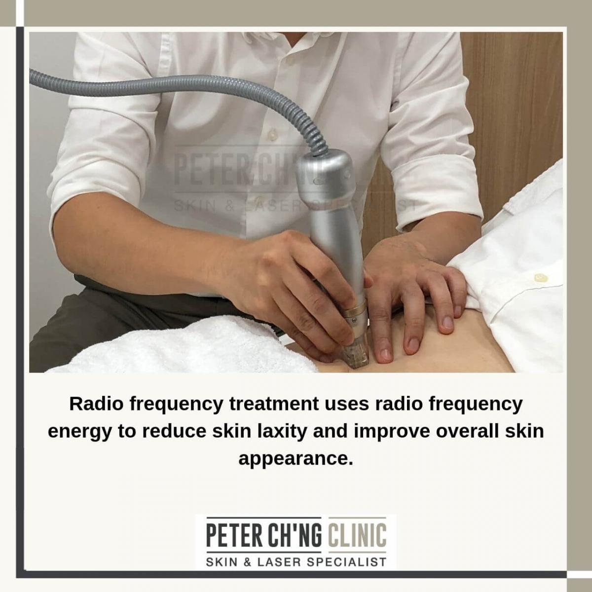 Radio Frequency Treatment