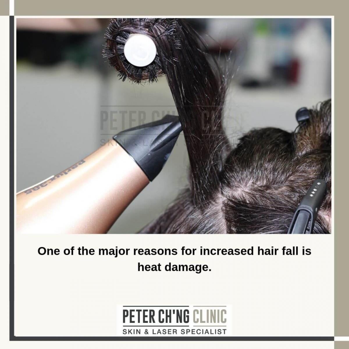 Ways to Reduce Hair Loss | Peter Ch'ng Skin Specialist - KL, Malaysia