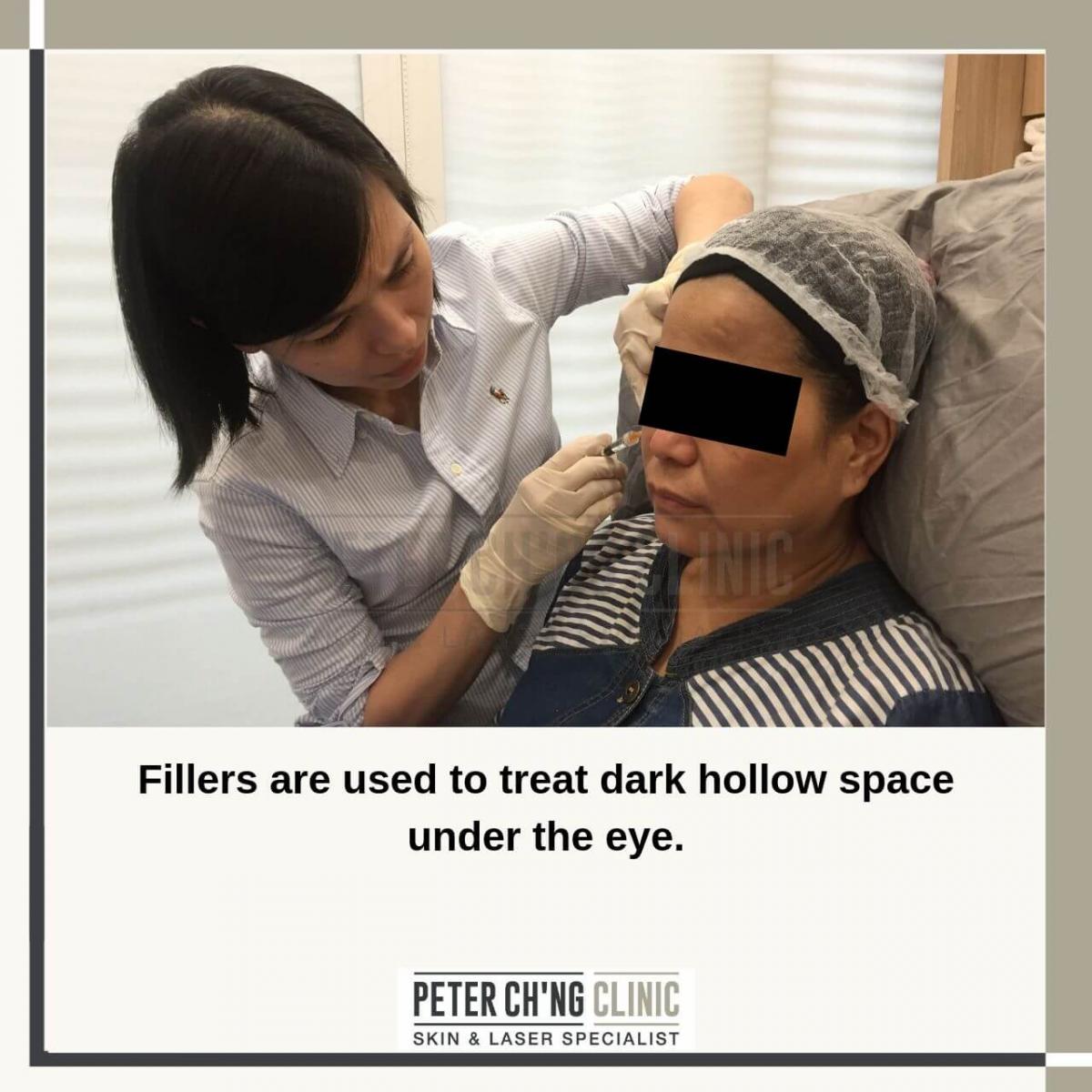 Filler
