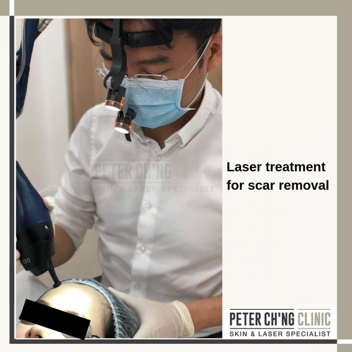 Laser treatment