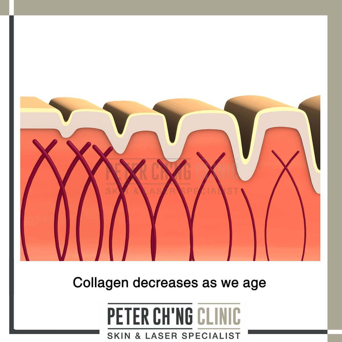 Collagen