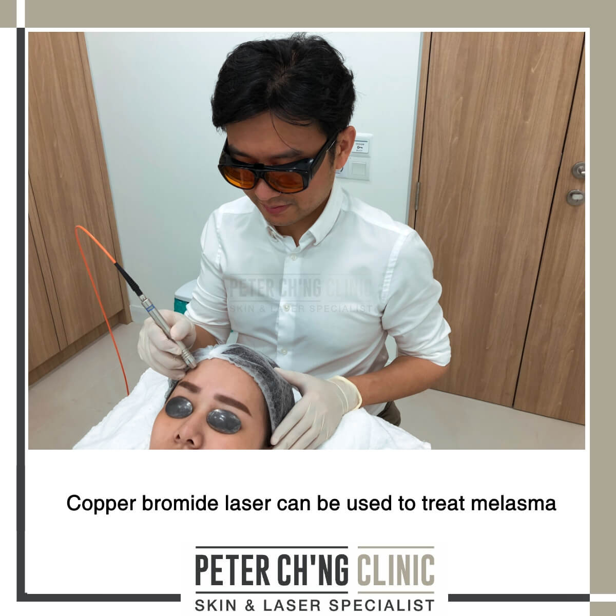 Copper bromide laser for melasma