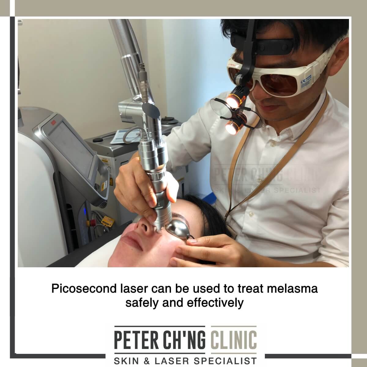 Picosecond laser for melasma