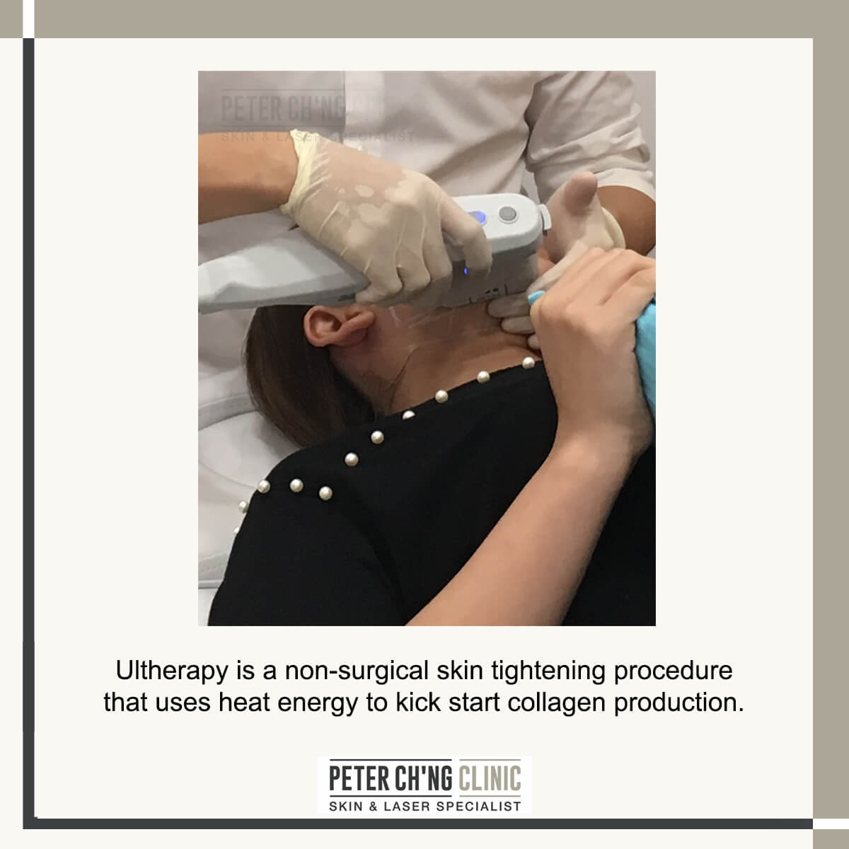 ultherapy process