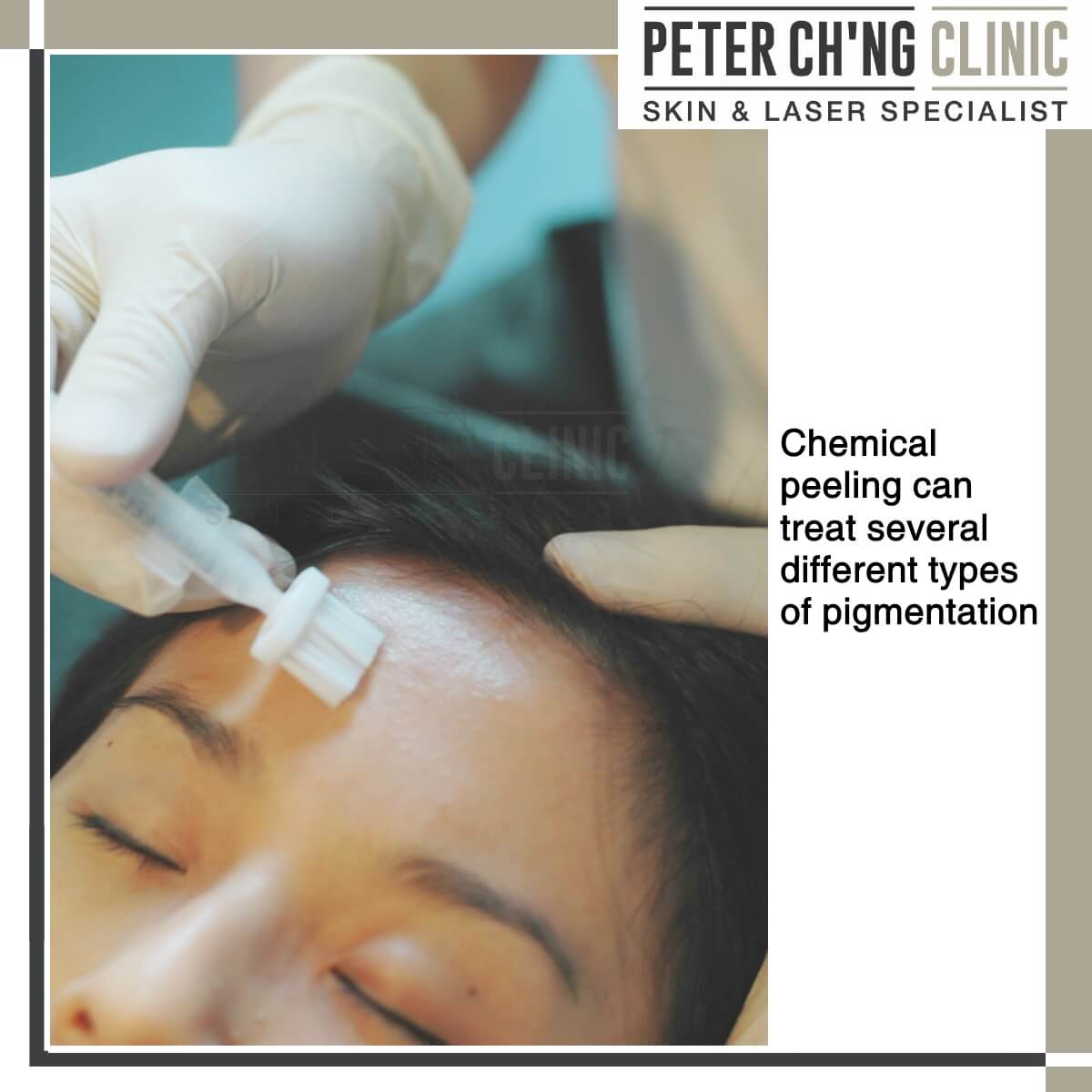 Chemical peeling for skin rejuvenation