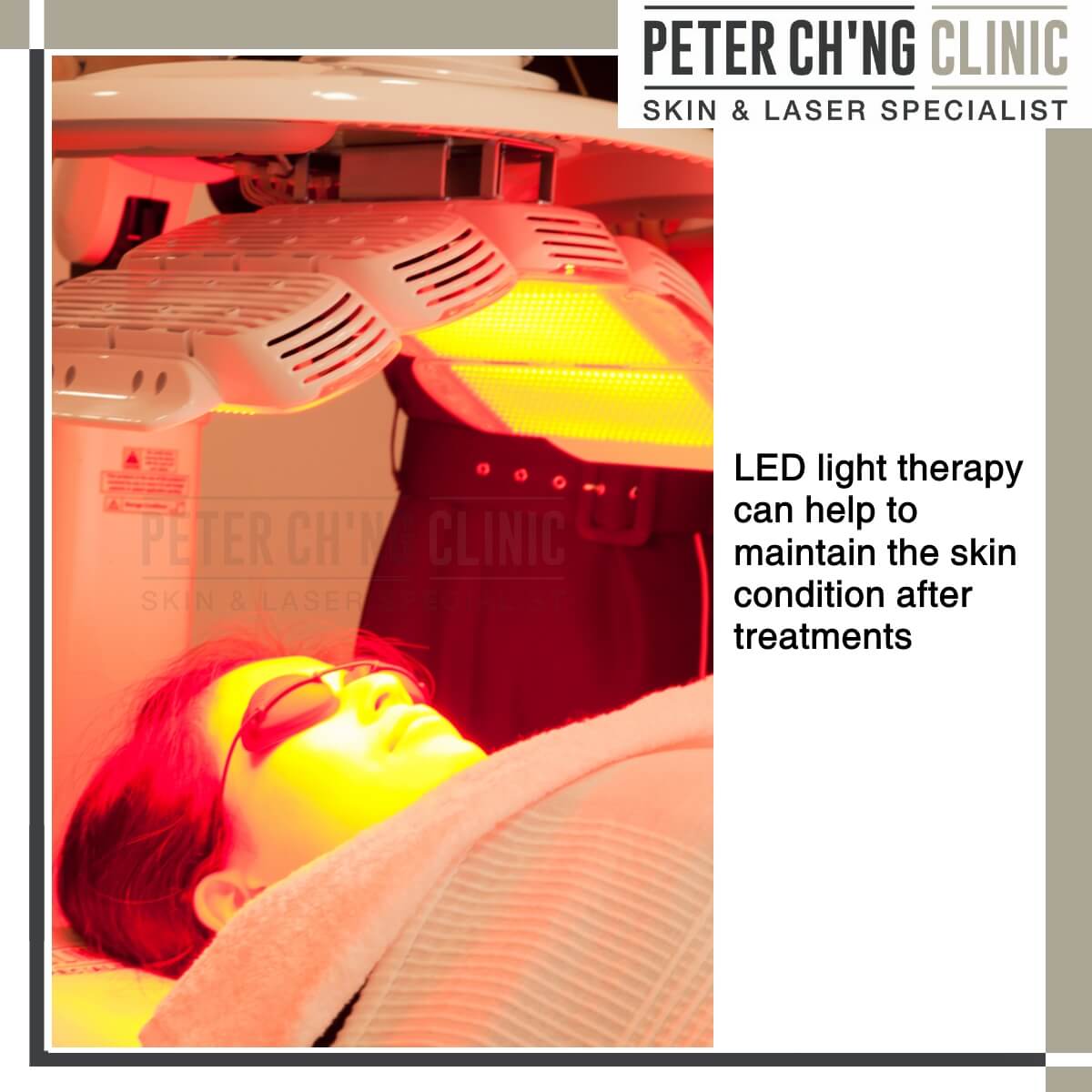 LED Phototherapy for melasma