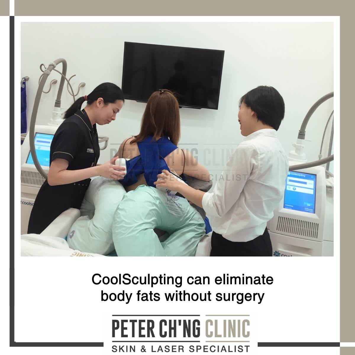 Coolsculpting