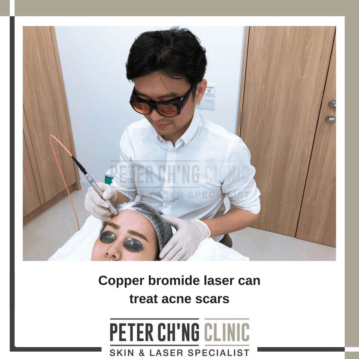 Copper bromide laser