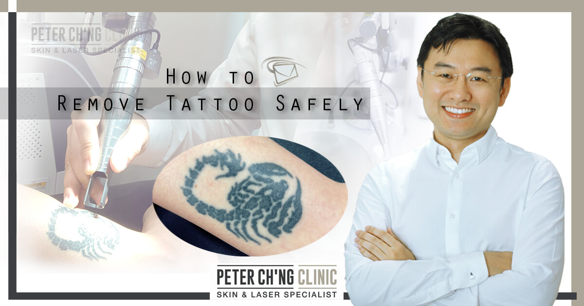 The INK Eraser: Celebrity Laser Tattoo Removal Specialist | The Ritz Herald