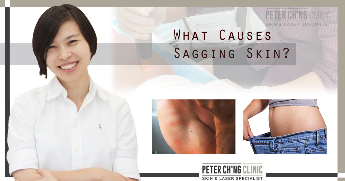 What Actually Causes Your Flabby Arms  Peter Ch'ng Skin Specialist - KL,  Malaysia