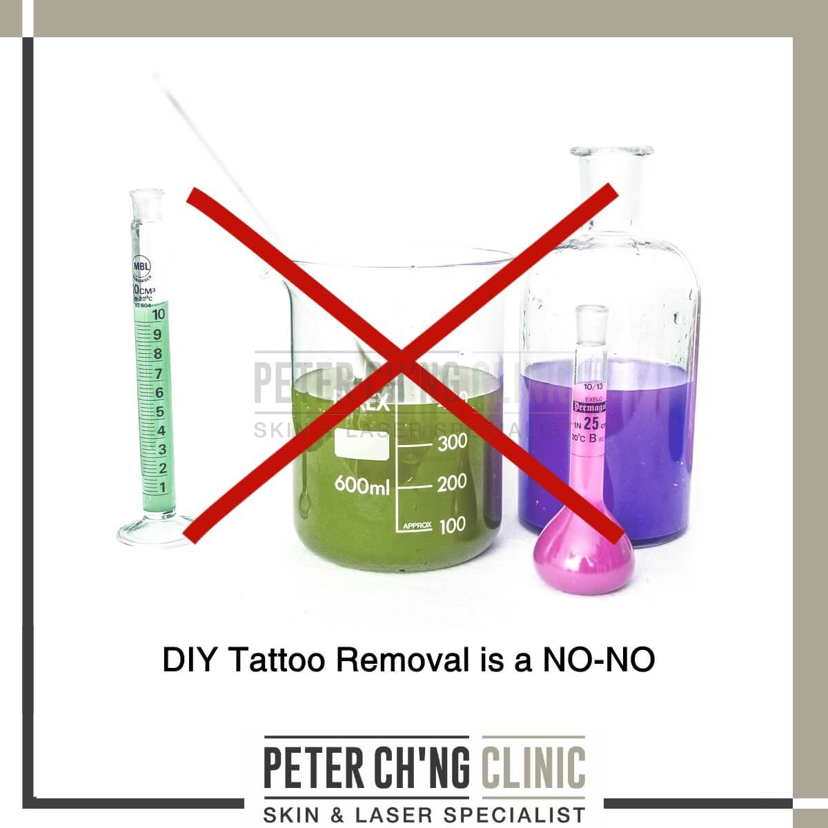 DIY Tattoo Removal
