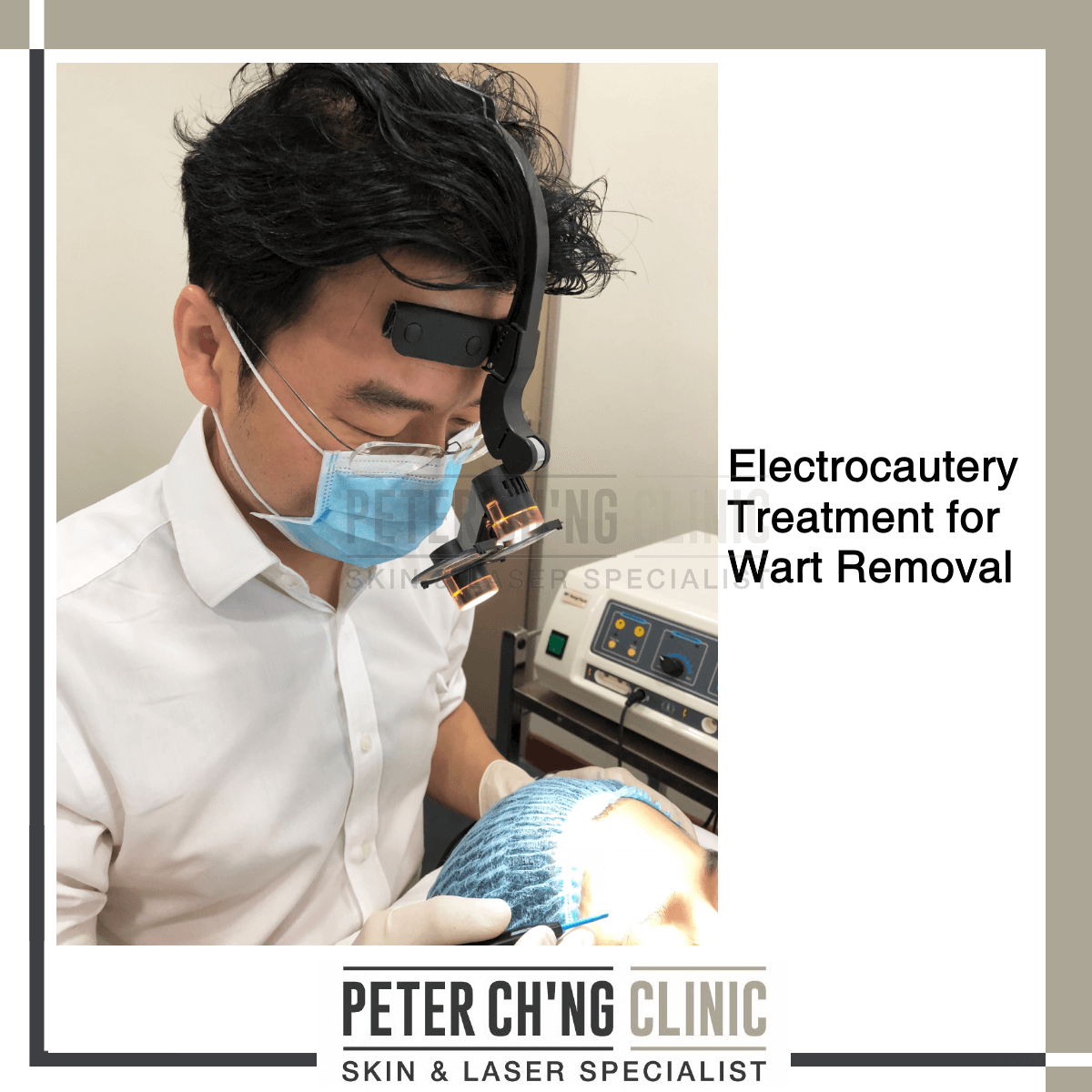 Electrocautery treatment