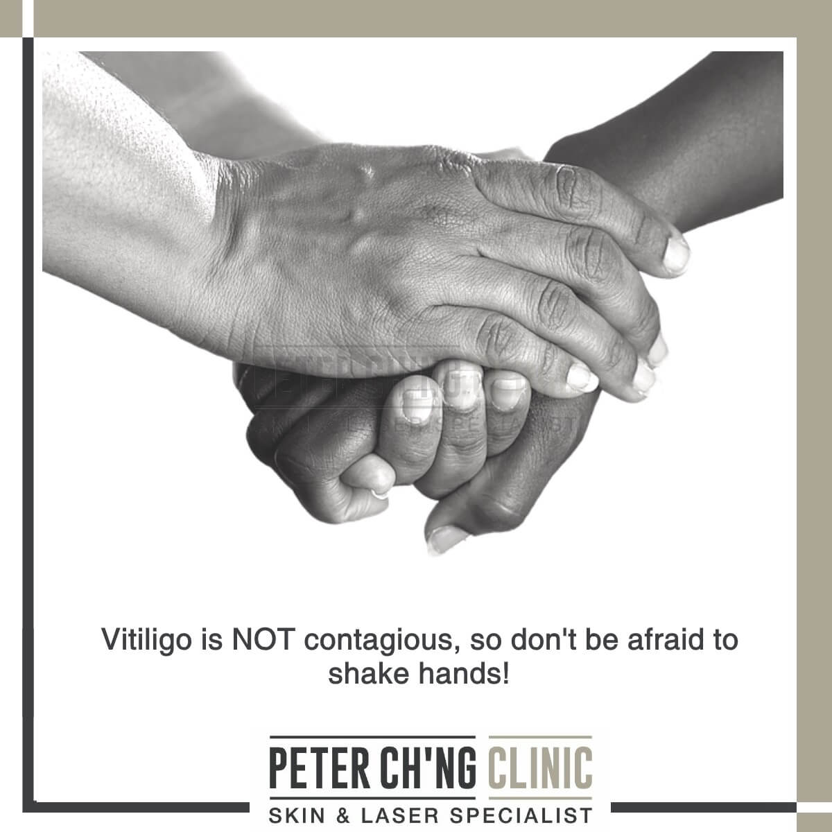Vitiligo is not contagious