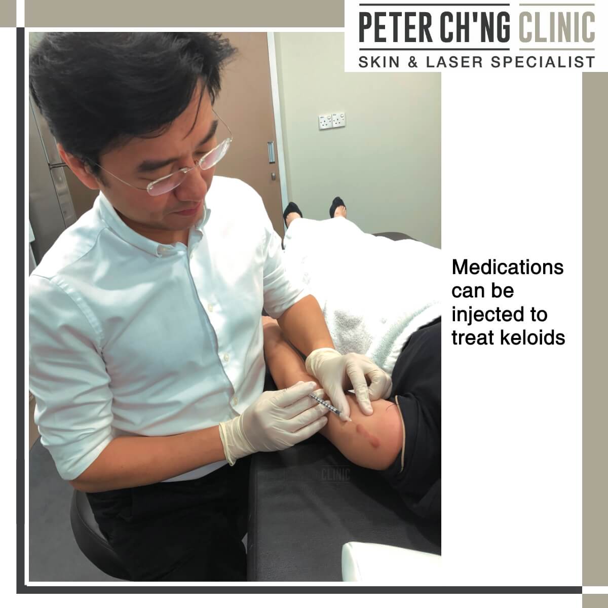 Patient Mailbox I Wish To Remove My Bcg Keloid Scar On My Arm Peter Ch Ng Skin Specialist Kl Malaysia