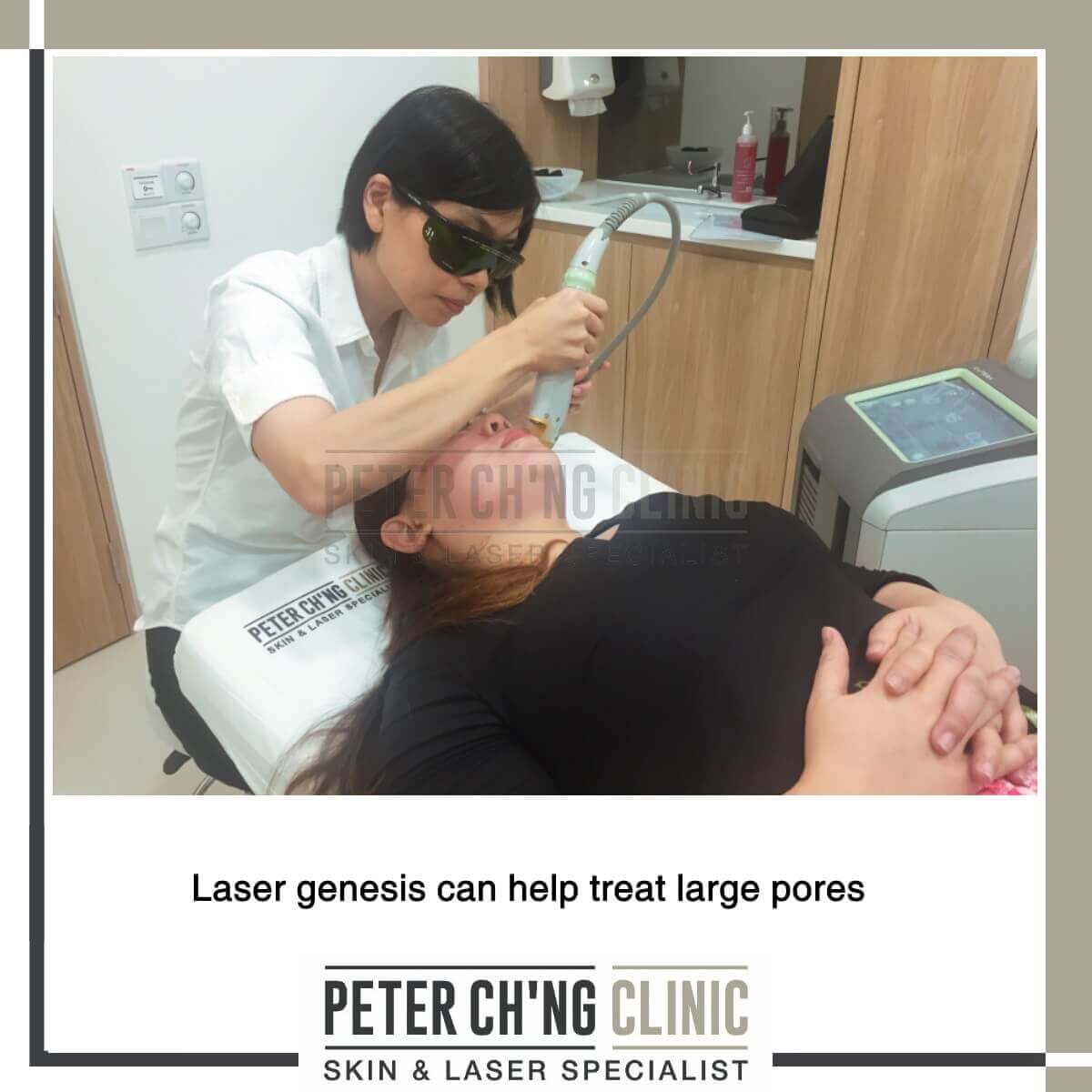 Laser treatment for large pores