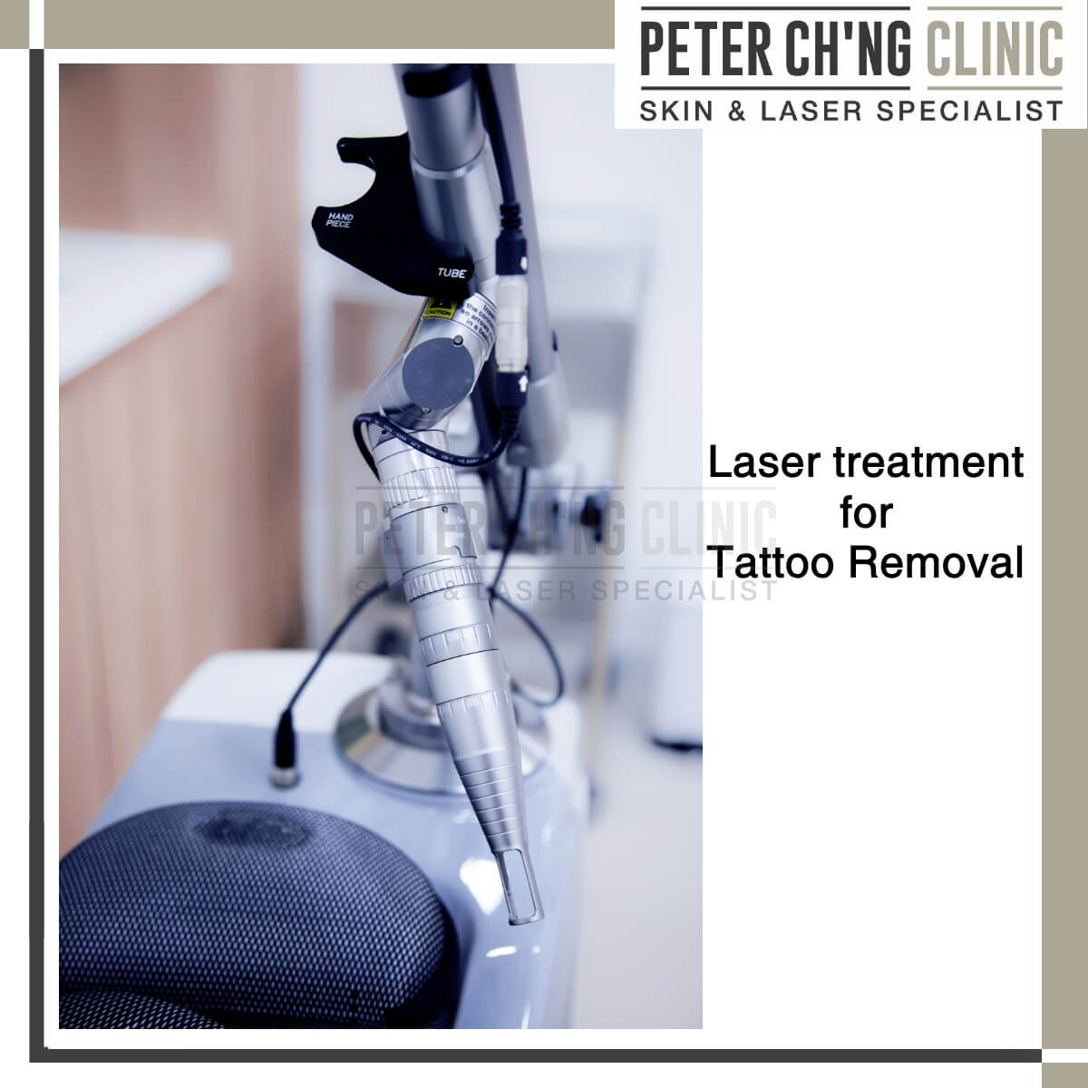 Laser tattoo removal