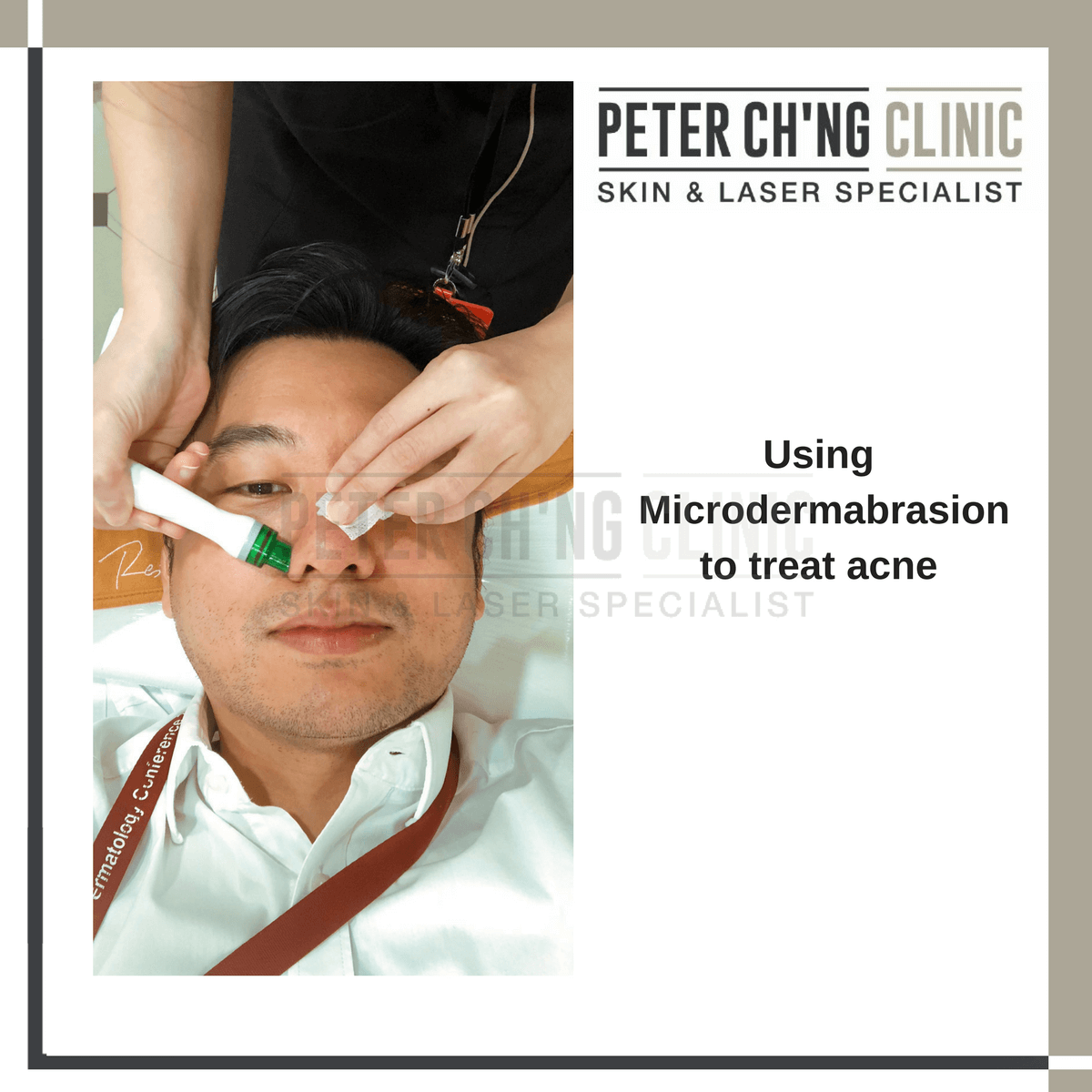 Microdermabrasion