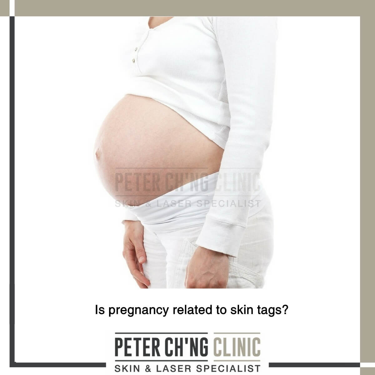 Pregnancy and skin tags