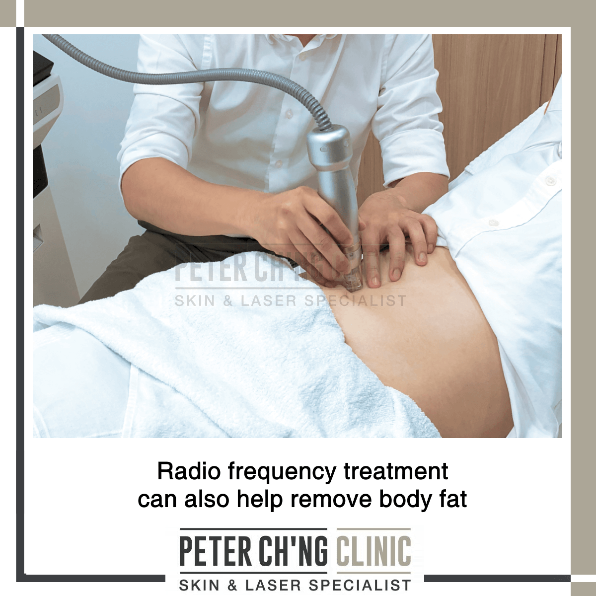 Radio frequency treatment