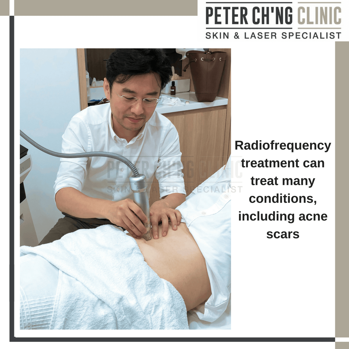 Radiofrequency treatment