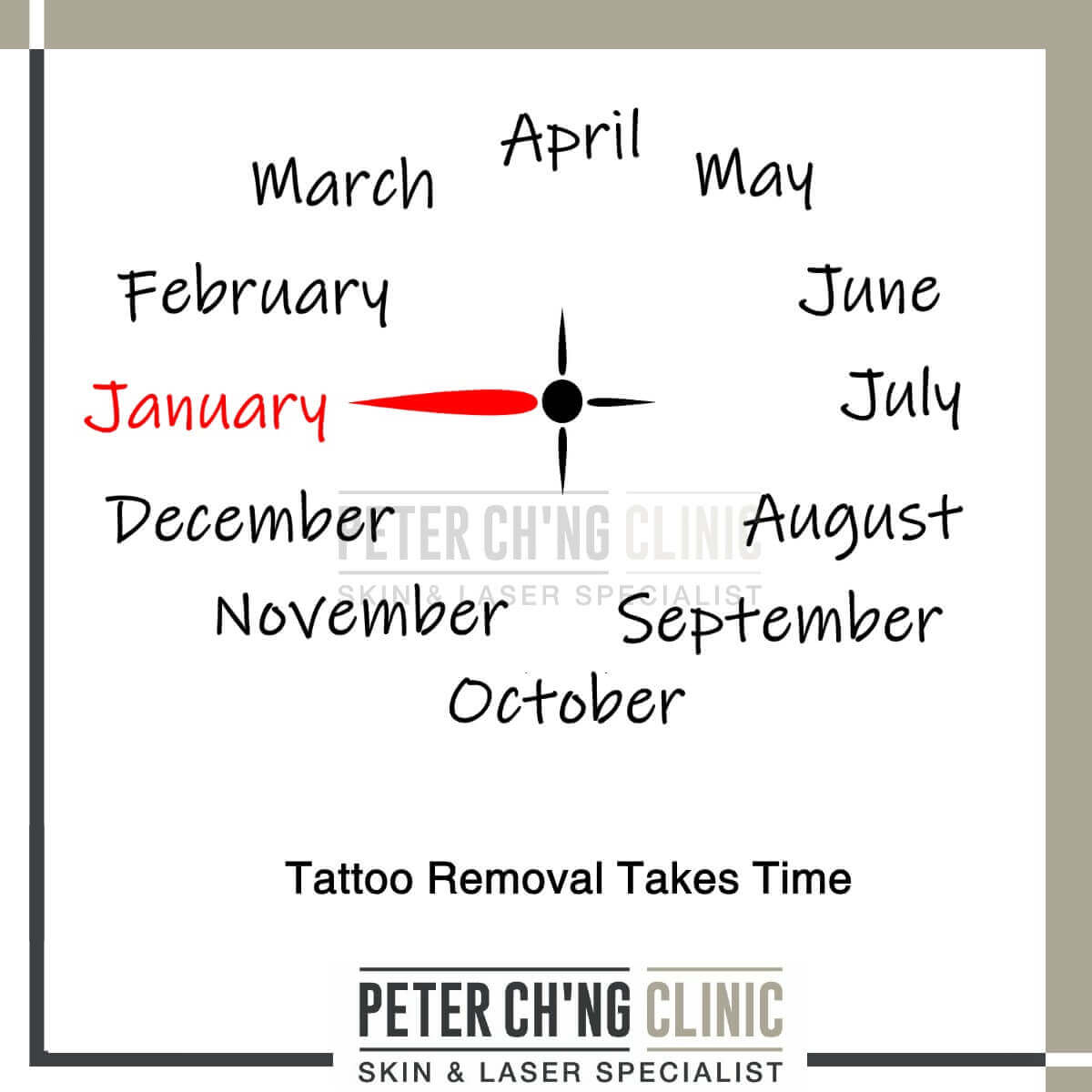 Tattoo removal takes time